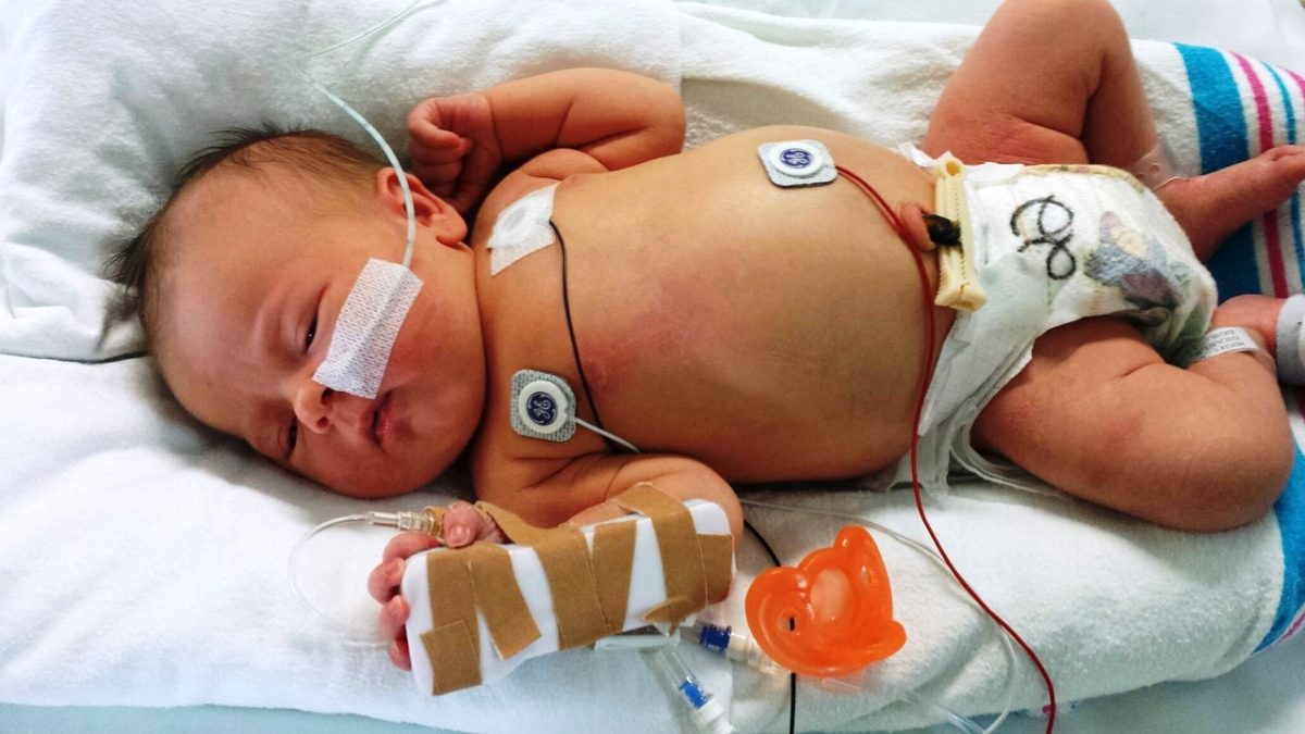 Lorsqu'un bébé est malade, il peut avoir besoin d'un apport supplémentaire d'oxygène pour aider à traiter son état de santé et à prévenir des complications respiratoires. Si le bébé présente des difficultés respiratoires, un médecin peut prescrir un dispositif d'administration d'oxygène tel qu'un masque ou des narines pour augmenter les niveaux d'oxygène dans le sang. Il est important de surveiller attentivement les signes vitaux du bébé, tels que le rythme cardiaque et la fréquence respiratoire, pendant qu'il reçoit de l'oxygène. Il est également important de suivre les instructions du médecin pour éviter tout risque de complications. Une surveillance médicale attentive peut aider à garantir une récupération rapide et en bonne santé pour le bébé malade.